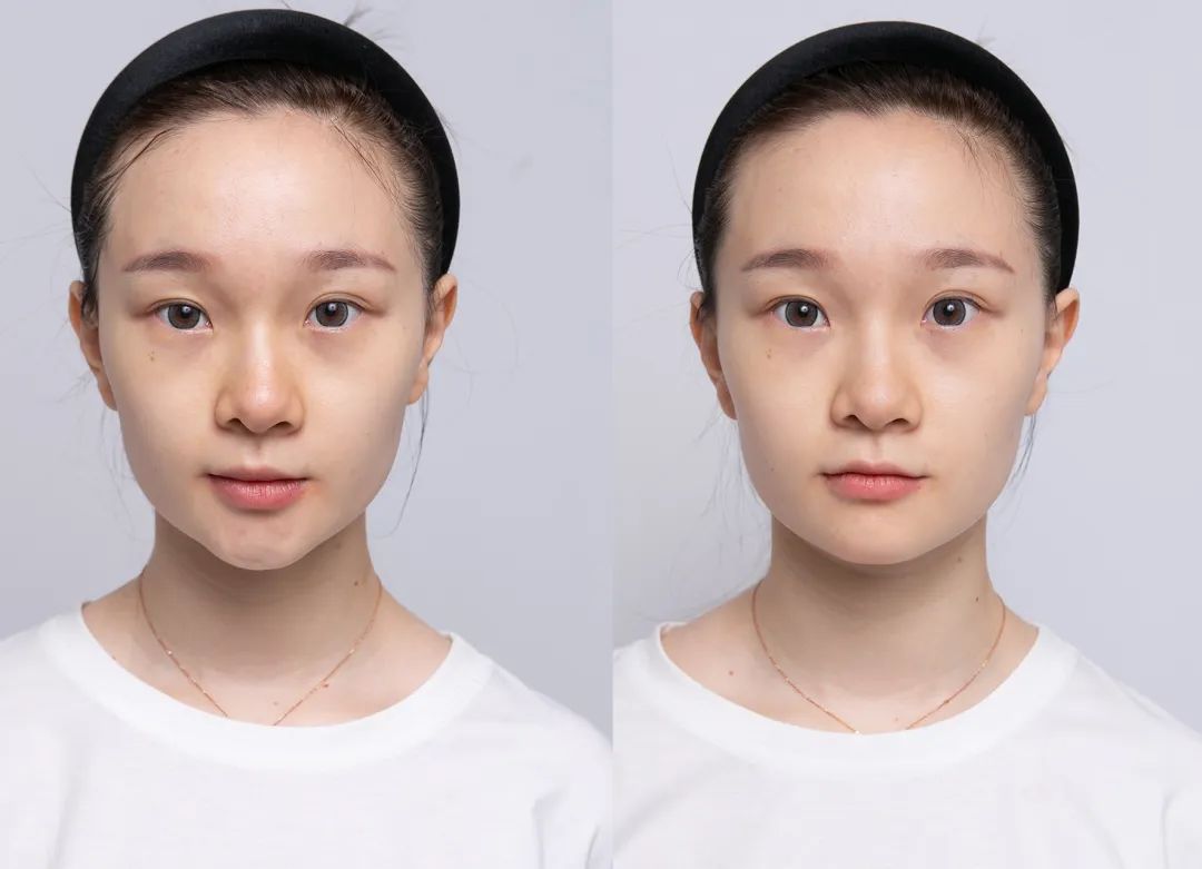 黄金美容最好的方法,黄金美容靠谱吗