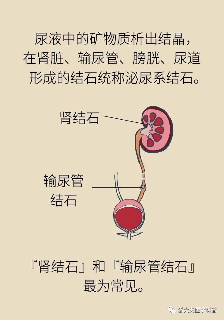 胆结石肝上也有结石怎么办,胆结石胆管里面有结石怎么办