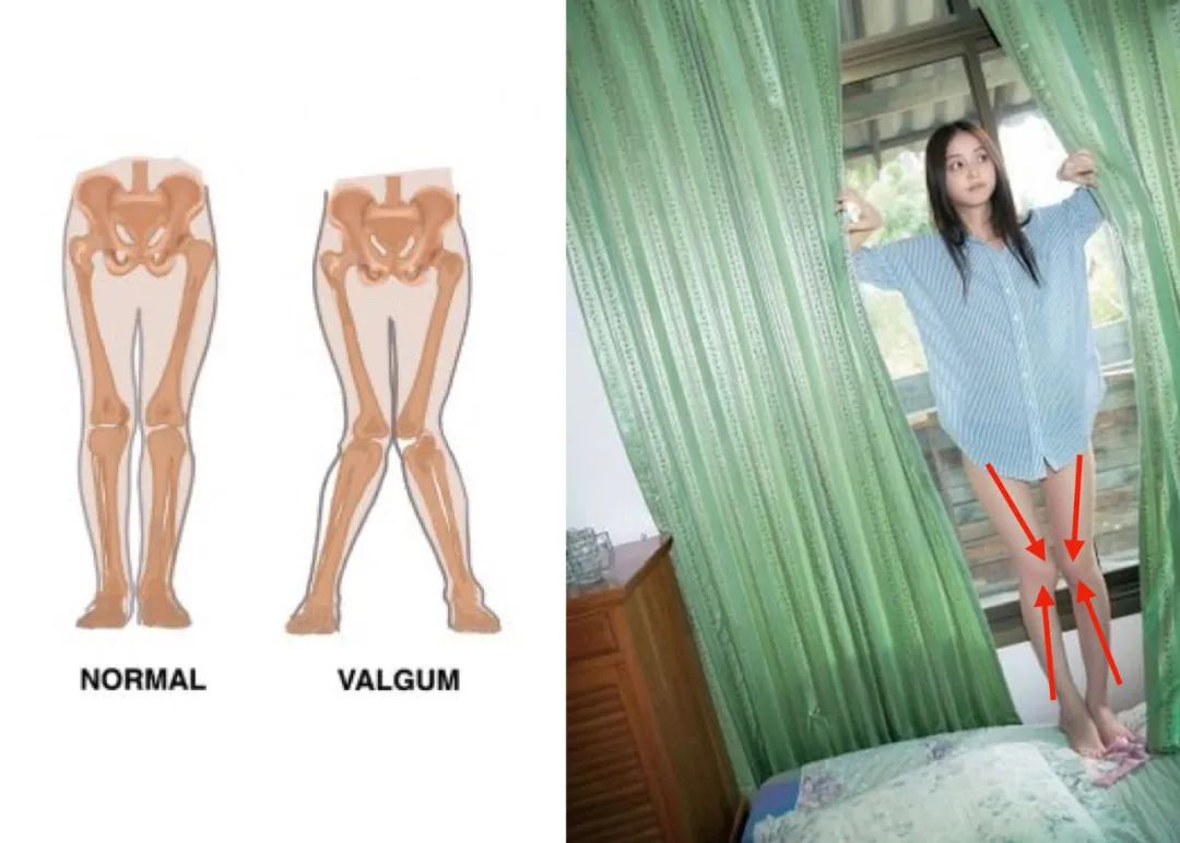 小个子胯宽腿粗牛仔裤,适合假胯宽的牛仔裤