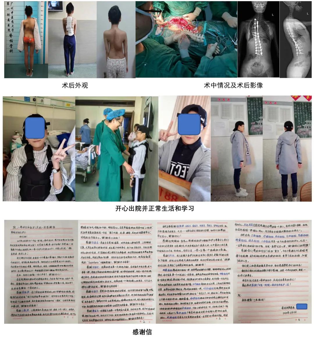 脊柱侧弯骨科治疗方法,筋骨堂正骨整脊理疗