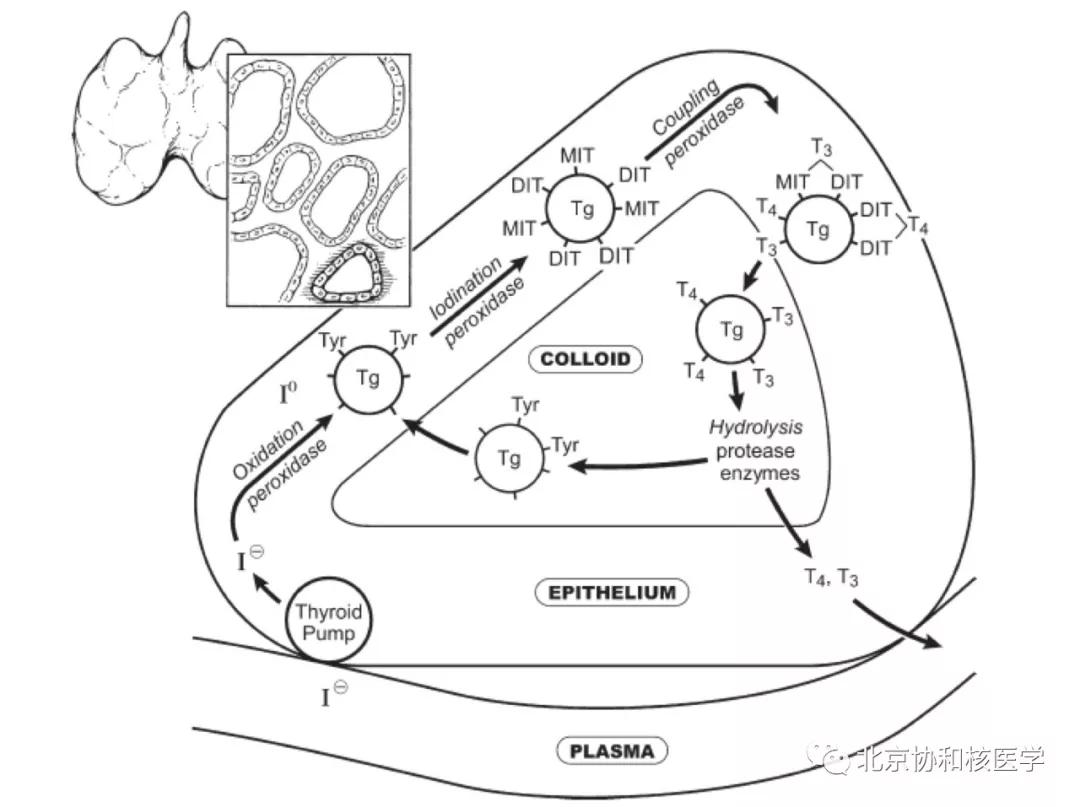 碘扫描最坏的结果,放射性核素扫描可以鉴别诊断吗