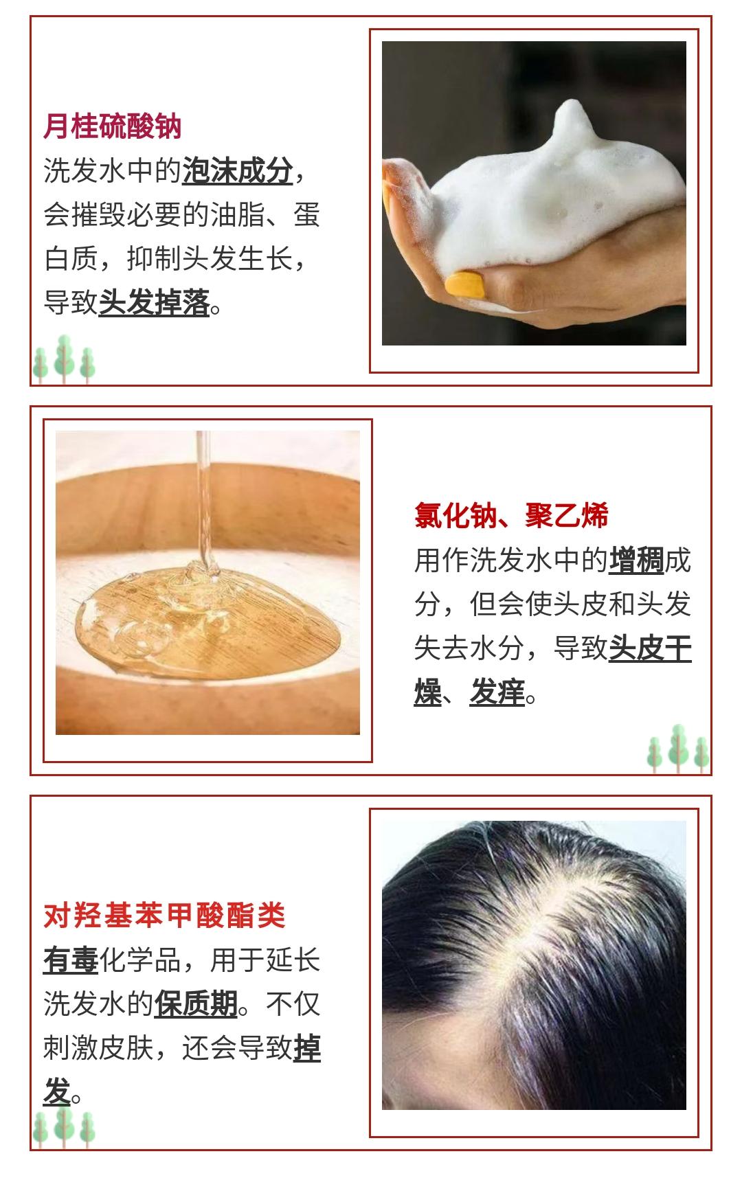 7天挑战无头屑,挑战5天不洗头依旧蓬松不油头