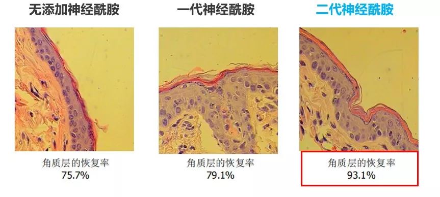 冬天宝宝脸干燥可以涂什么护肤品,儿童护肤冬季防皲裂