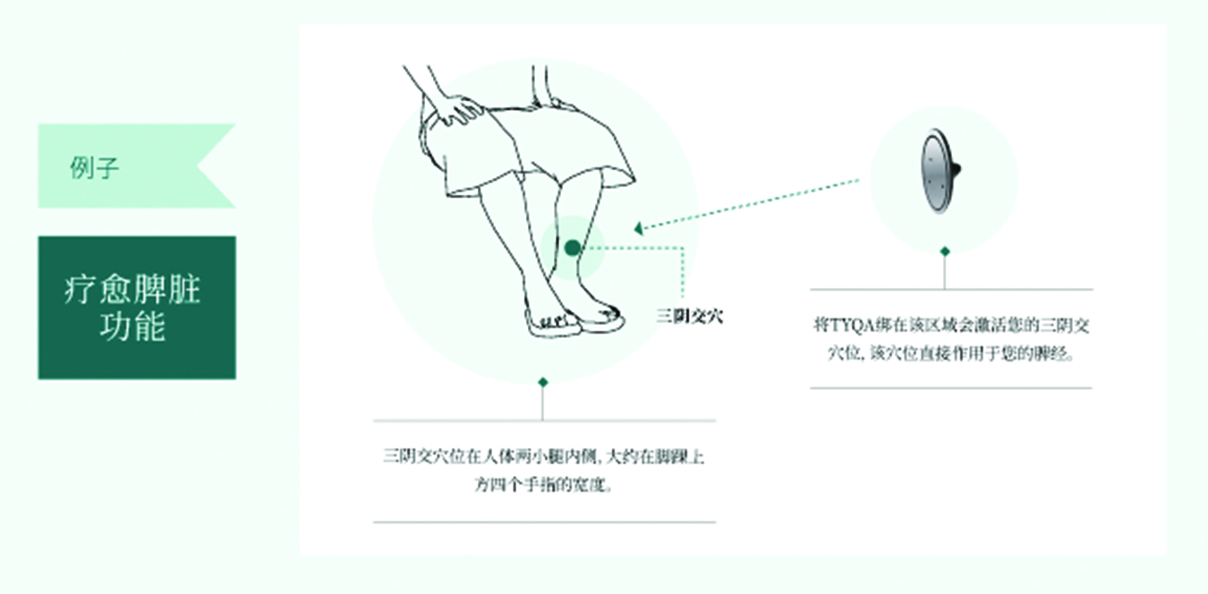 TYQA针灸2.0无痛的针灸获美国FDA注册高科技可佩戴的医疗器械