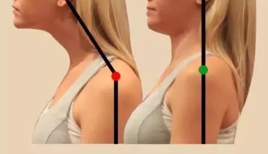 含胸驼背最损气质手把手教你纠正,含胸驼背如何改善提升气质