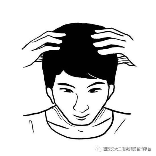 秃如其来如何拯救,秃如其来如何拯救我们的头