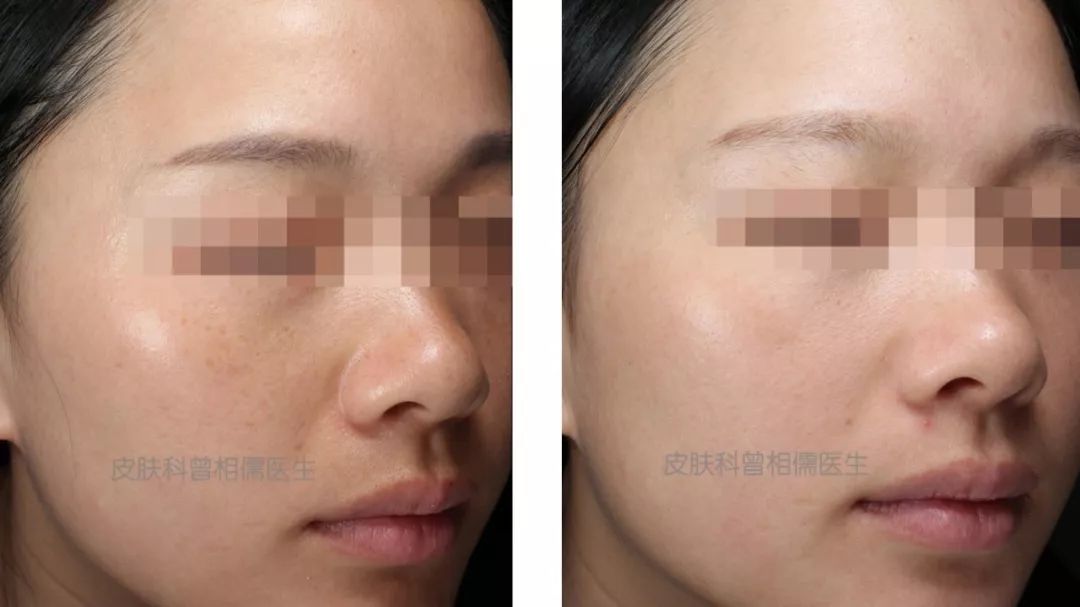 坚持美白全身,坚持做什么可以美白