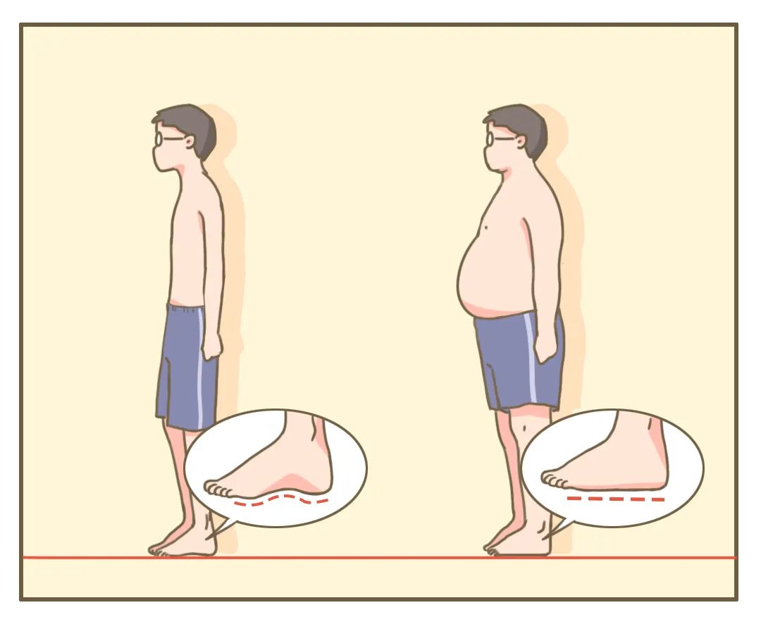 总嚷嚷走不动的人，可能是脚没长对