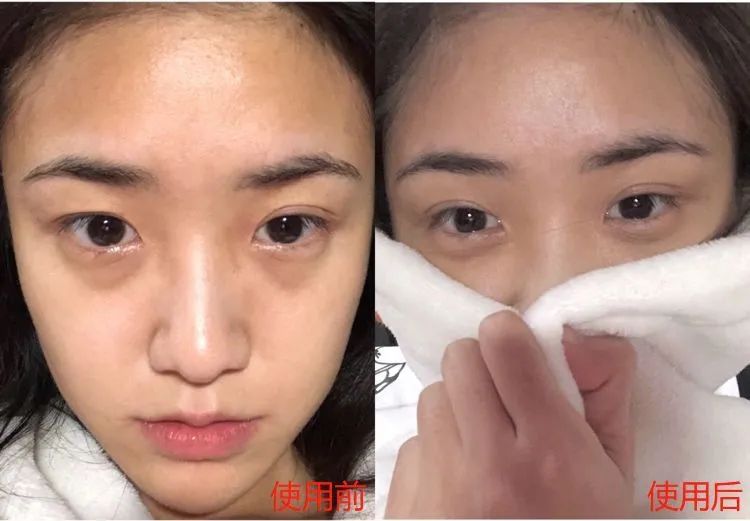 60岁没眼袋方法,教你一招去眼纹