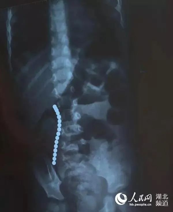 当心这款网红玩具已致多人受伤,有毒这些网红玩具千万别乱买