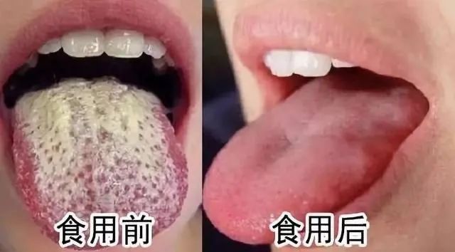 感觉嘴里有股肠胃的臭味,肠胃有一股腐臭味怎么回事