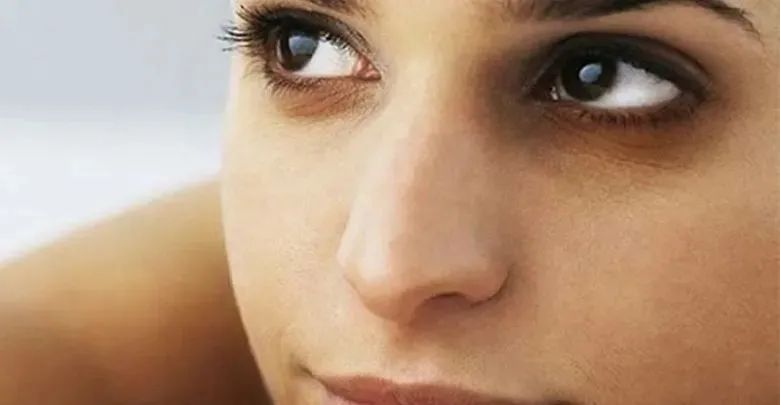 严重黑眼圈是身体发出的信号吗,黑眼圈不可怕