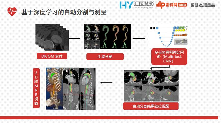 ai辅助医生心血管疾病诊断效率,ai技术治疗心血管疾病