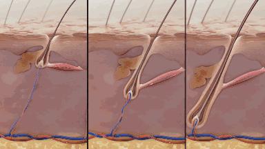 火遍全网的生发养发防脱固发,去屑止痒防脱养发