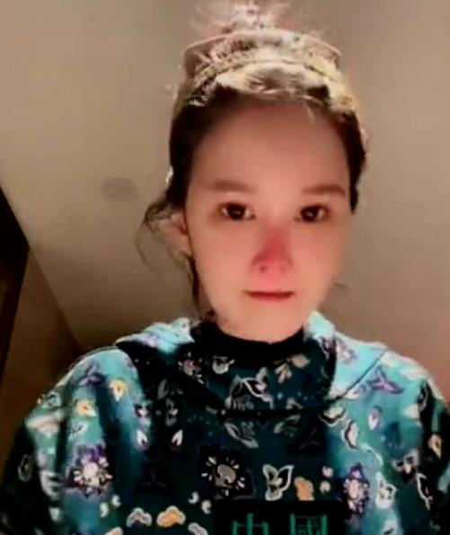 赵本山女儿承认整容了吗,赵本山女儿整容被质疑