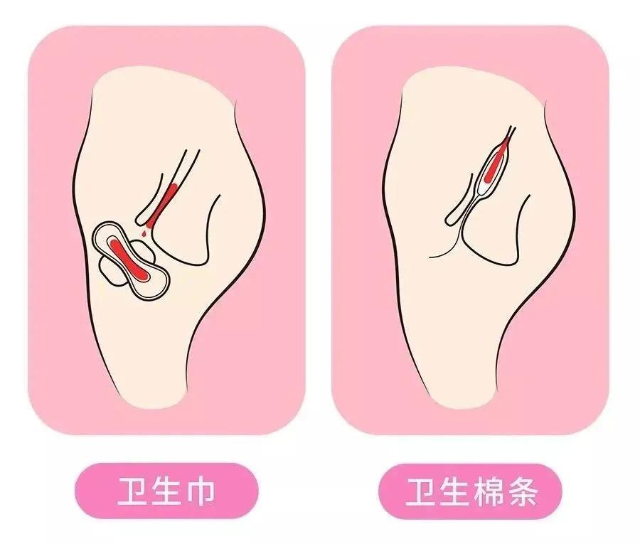 解决月经期量大、侧漏、有异味的好物,竟然还有人没用过?