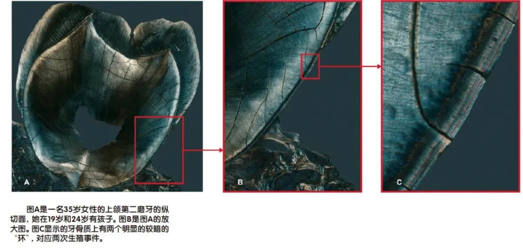 “牙相”大师：一颗牙阅读你的一生