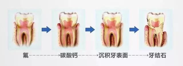 拯救牙黄牙黑口臭的看过来,黄牙黑牙有救了