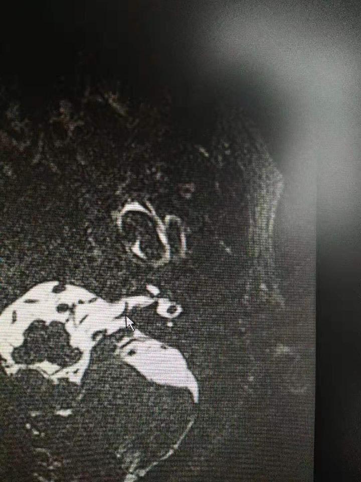 搬家后站立都成了奢望,59岁阿姨:一天头晕几十回,真是因为风水不好吗?