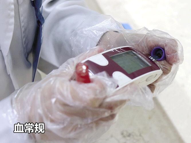 家长注意！2020年贵州血管瘤胎记健康筛查福利已发放仅限45名！速领