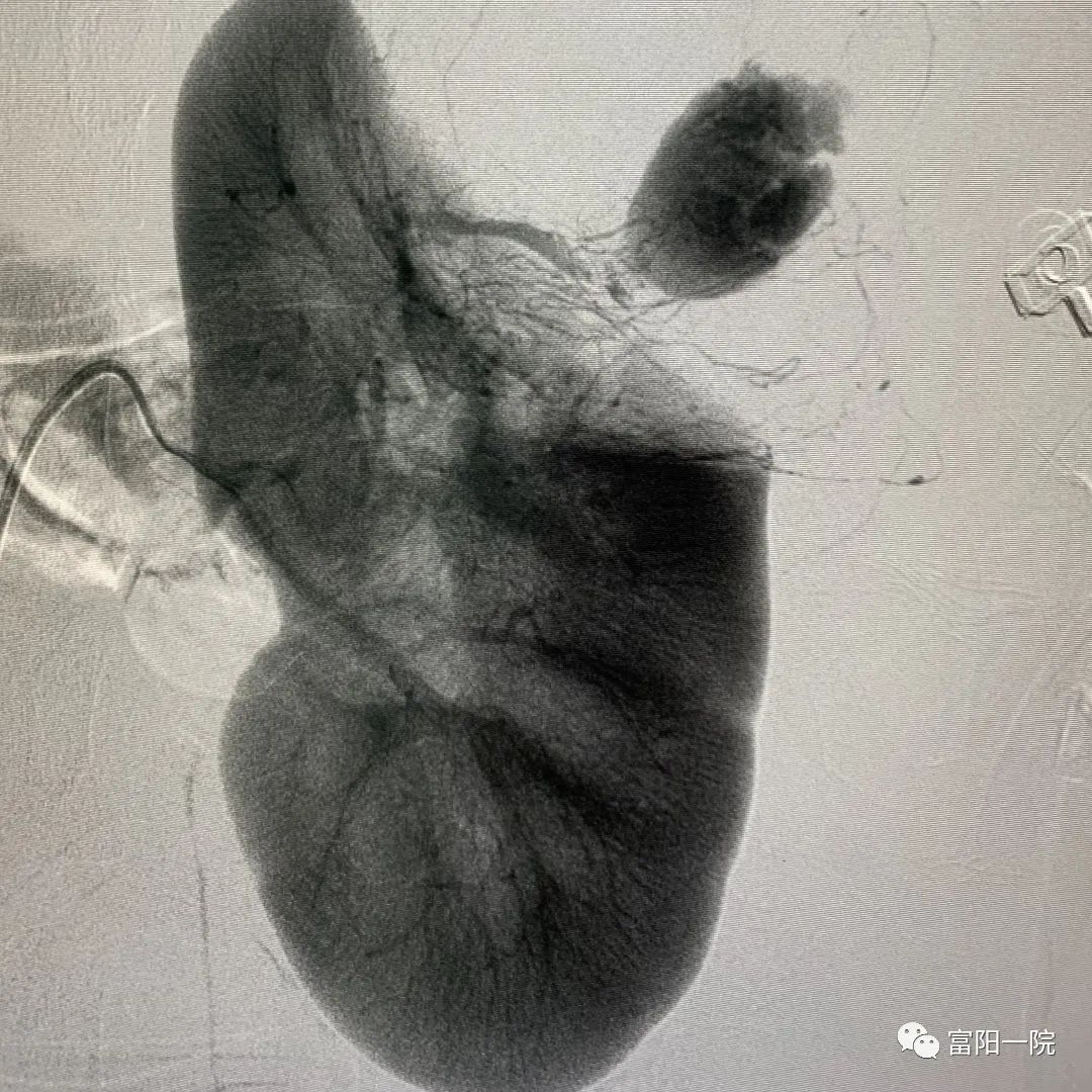 孕29周突然拉肚子,孕29周突然拉肚子正常吗