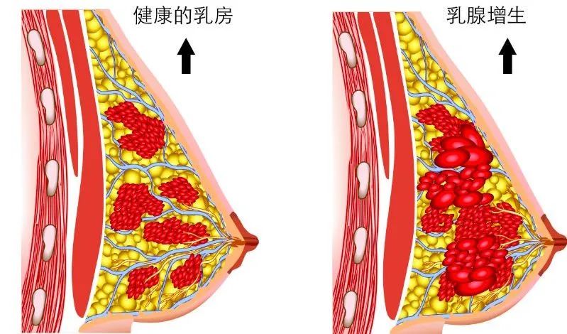 有什么方法可以丰胸不用丰胸产品,其实丰胸很简单呀