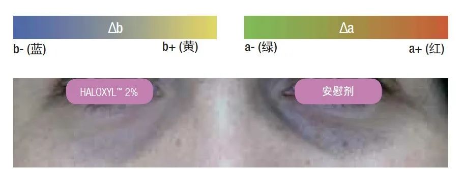 欧阳娜娜关晓彤眼霜,欧阳娜娜眼霜去黑眼圈