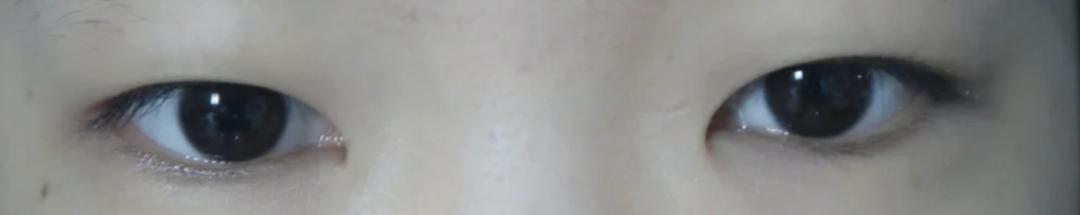 欧阳娜娜关晓彤眼霜,欧阳娜娜眼霜去黑眼圈