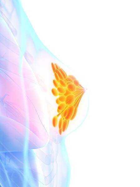 乳房上长个15公分大瘤严重吗,乳房有一个一公分的瘤