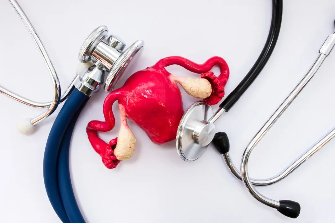 子宫内膜癌的高危三联征，你有吗？