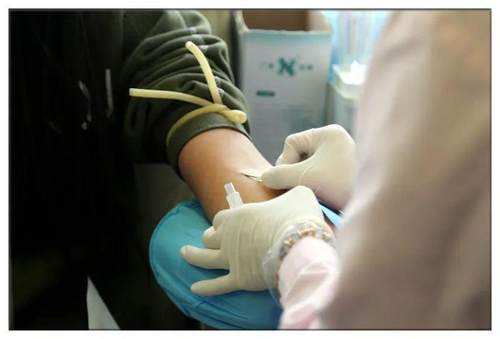 献血怎么按压针眼,献血后针眼附近青紫怎么办