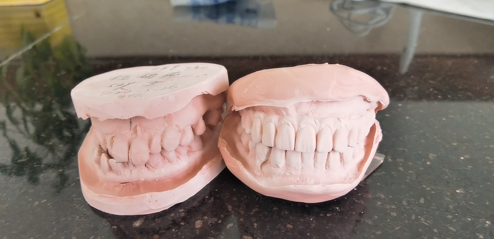 种植牙医保和自费相差多少钱,种植牙费用医保能报多少