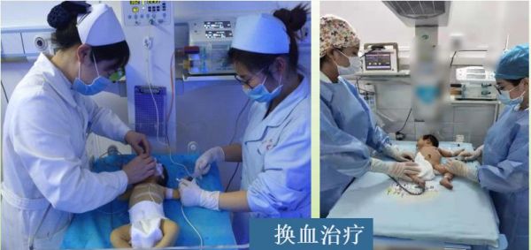 刚出生的宝宝黄疸怎么预防,新生宝宝为什么容易出现黄疸