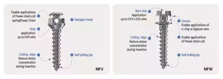 正畸主治学习视频,正畸钟摆效应名词解释