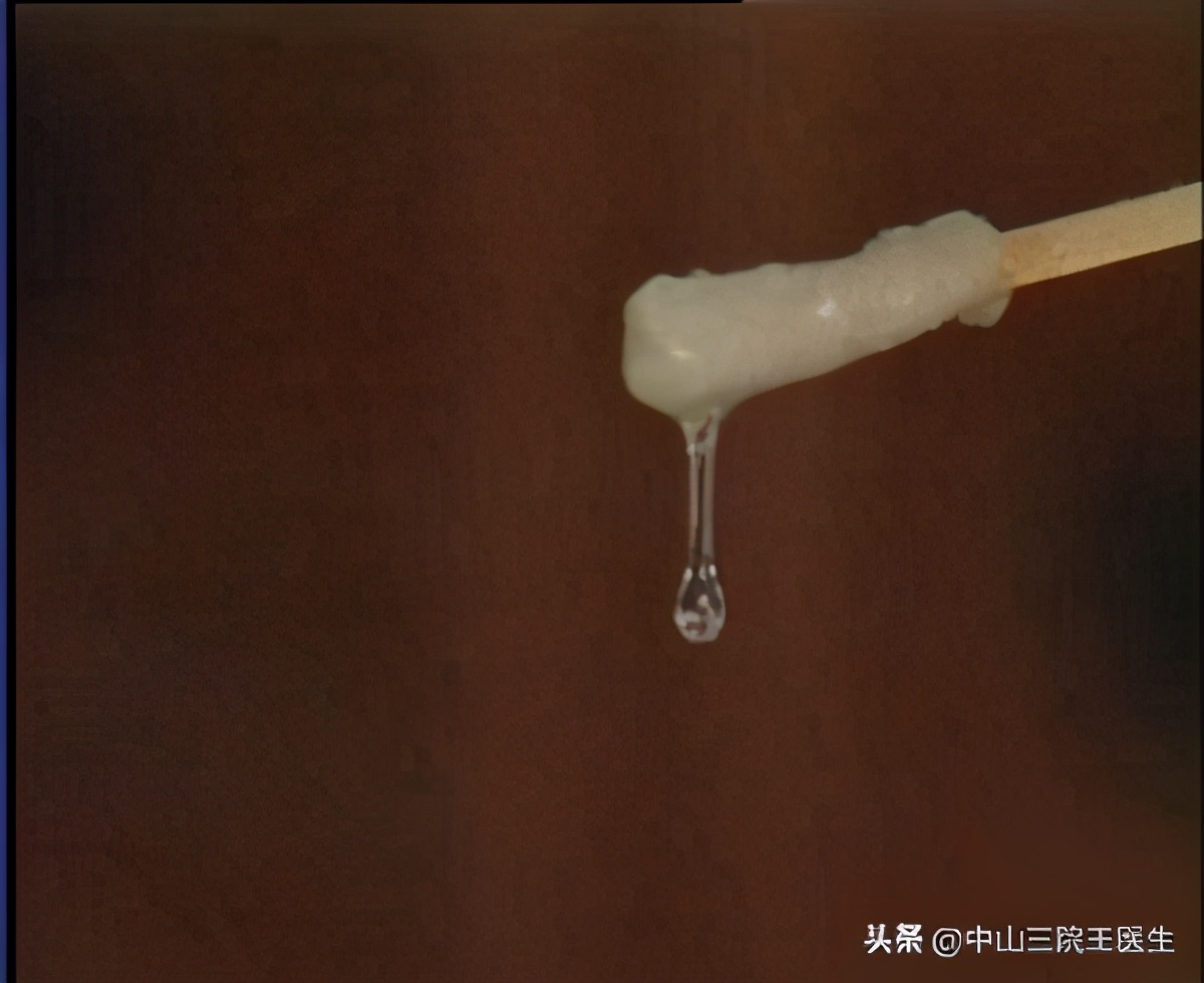 白带健康的晴雨表是什么意思,白带是健康的晴雨表