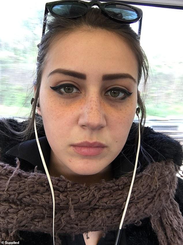 梅根福克斯素颜雀斑,英国女子患罕见疾病毁容