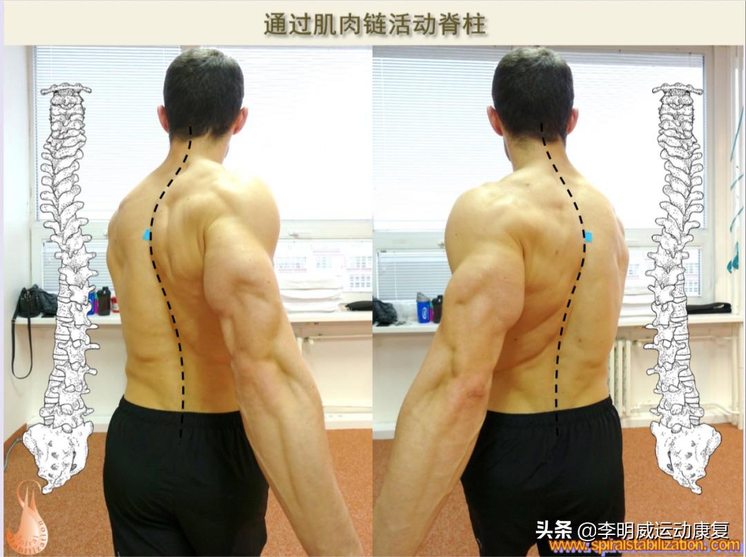 脊柱侧弯视频完整版,脊柱侧弯最好的医院