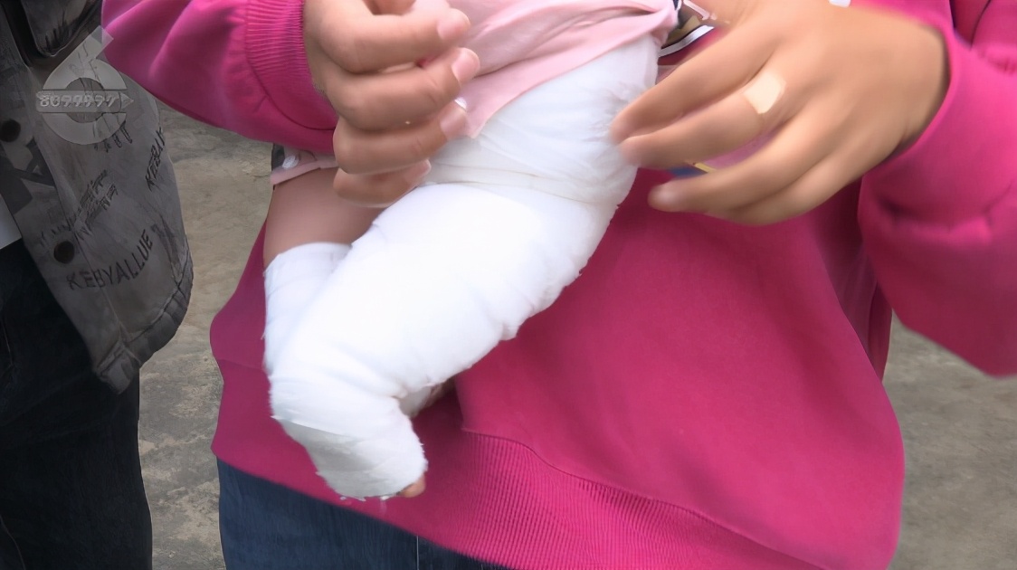 小孩在店里被烫伤要赔多少钱,母婴店洗澡被烫着的孩子