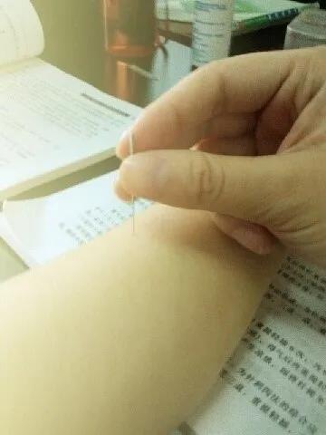 针灸推拿专业咋样有前景吗,针灸推拿专业本科大三课程