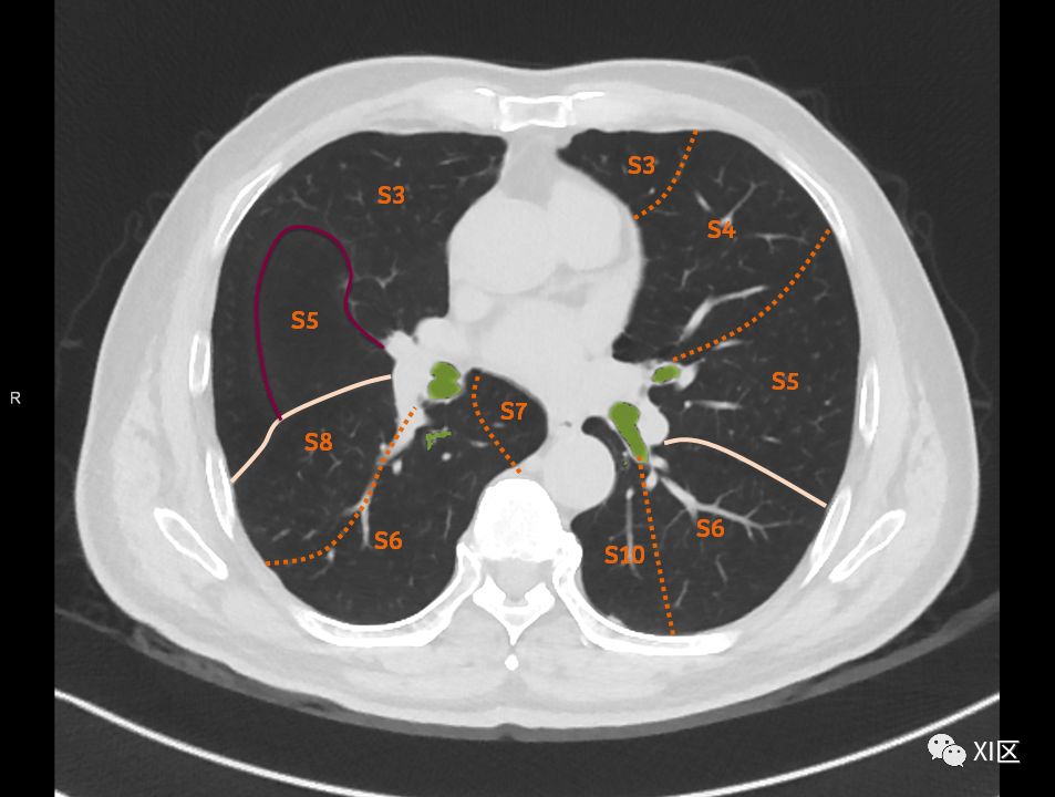 如此详细的肺部影像解剖，有点儿酷！