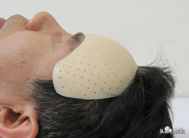 宁静和郑希怡对比,郑希怡和宁静对比