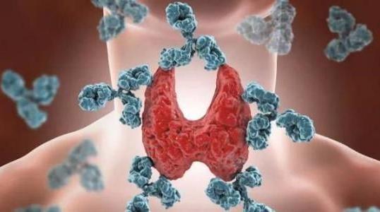 甲状腺良性滤泡性结节会癌变吗,甲状腺良性滤泡结节癌变率有多高