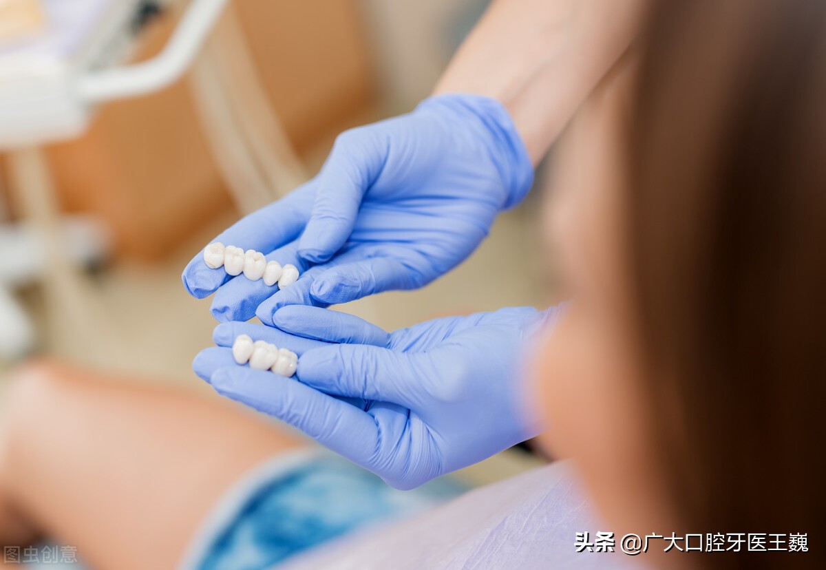 全瓷牙和烤瓷牙的寿命多少年,全瓷牙和烤瓷牙哪个需要磨牙多