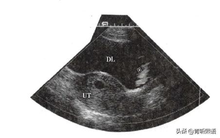 没精神老想瞌睡是怎么回事,老是没精神想睡觉看什么科