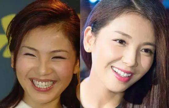 为什么有些女人戴口罩会变好看,为什么好多女的上街戴口罩