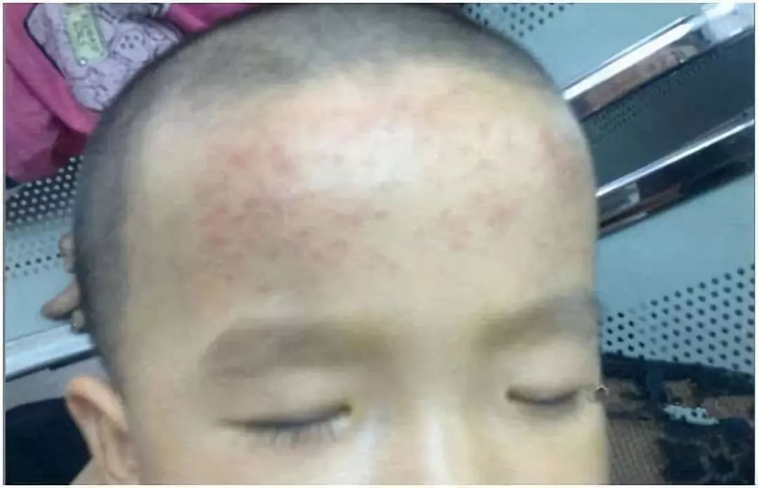 德州小儿退烧贴,退热贴德州