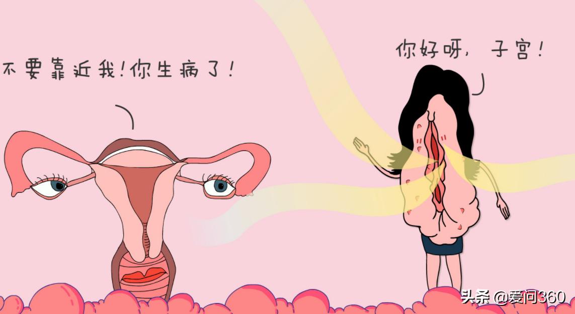 妇科炎症是不是不注意清洁,妇科不注意卫生会引发什么