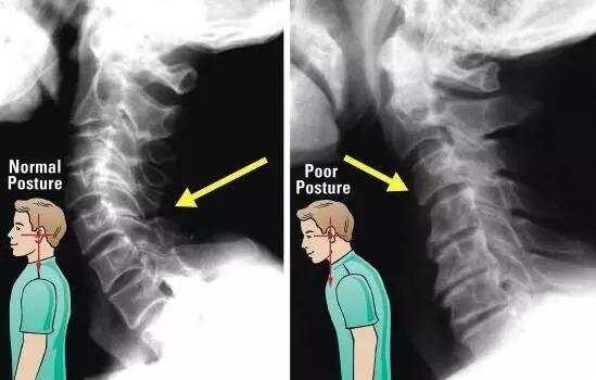 手臂发麻又酸痛是怎么回事,手臂总感觉发麻是什么原因