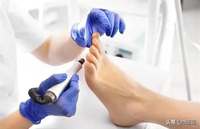 肝不好足先知脚上出现3种迹象,肝不好脚先知4个征兆