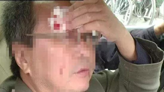 金湾两名男子被“枣核钉”误伤！血流不止！原来竟是泥头车惹的祸！